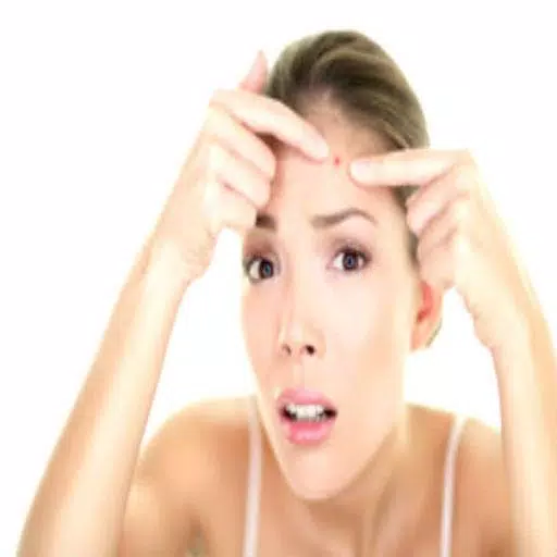 Get Rid of Acne (Guide) Screenshot 0